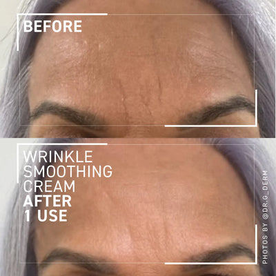 Needles No More Wrinkle Smoothing Cream