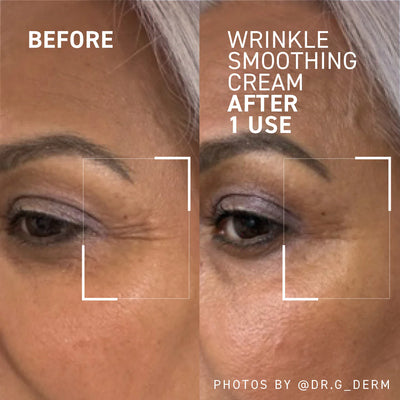 Needles No More Wrinkle Smoothing Cream