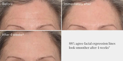 Under the Microscope: The Wrinkle Fighters