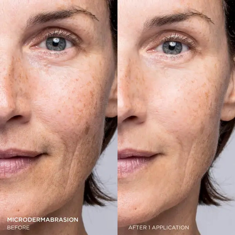 Microdermabrasion age defying exfoliator