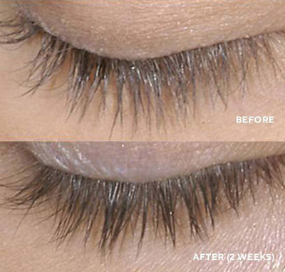 Lash Serum