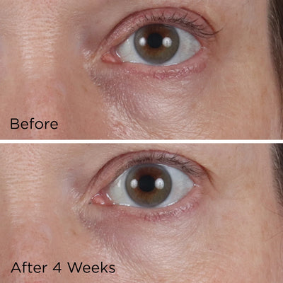 Vitamin C Ester CCC+ Ferulic Brightening Under-Eye Cream