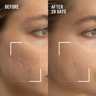 Microdermabrasion age defying exfoliator