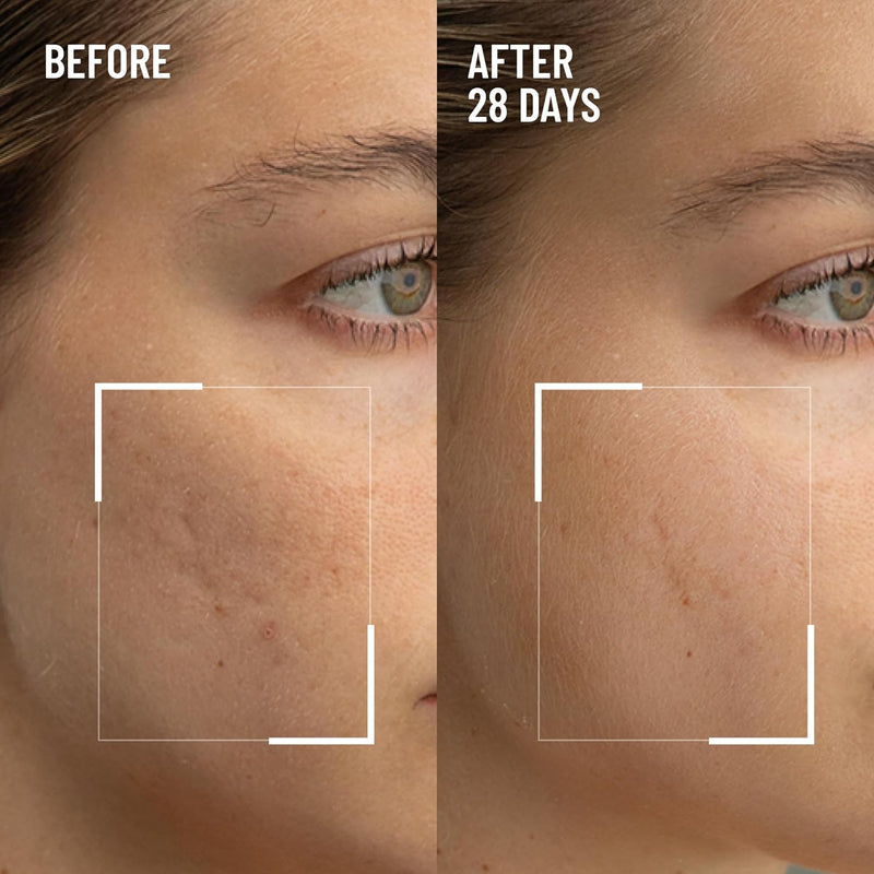 Microdermabrasion age defying exfoliator