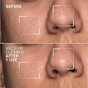 Pores No More Vacuum Cleaner Pore Purifying Mask