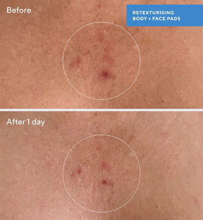 Retexturizing Body Pads