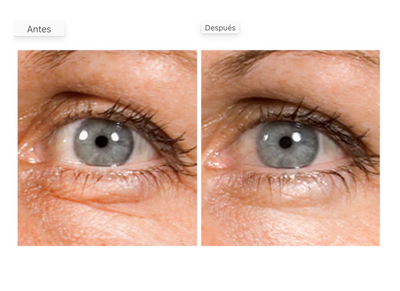 Anti-Wrinkle Eye Treatment STEM CELLULAR™