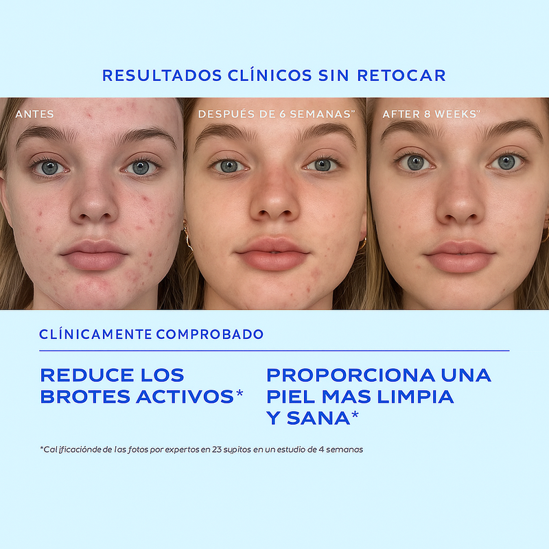 Biome-Balancing Clear & Prevent Acne Treatment Serum