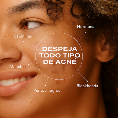 Biome-Balancing Clear & Prevent Acne Treatment Serum
