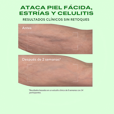 Retinal ReSculpt Body Treatment