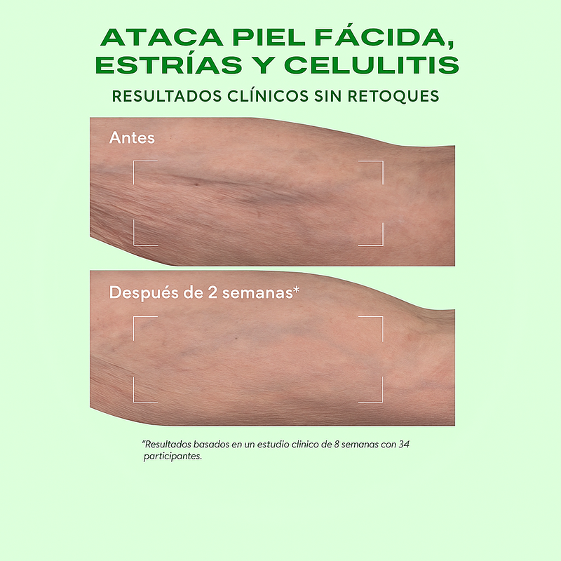 Retinal ReSculpt Body Treatment