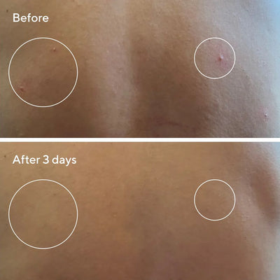 Retexturizing Body Pads