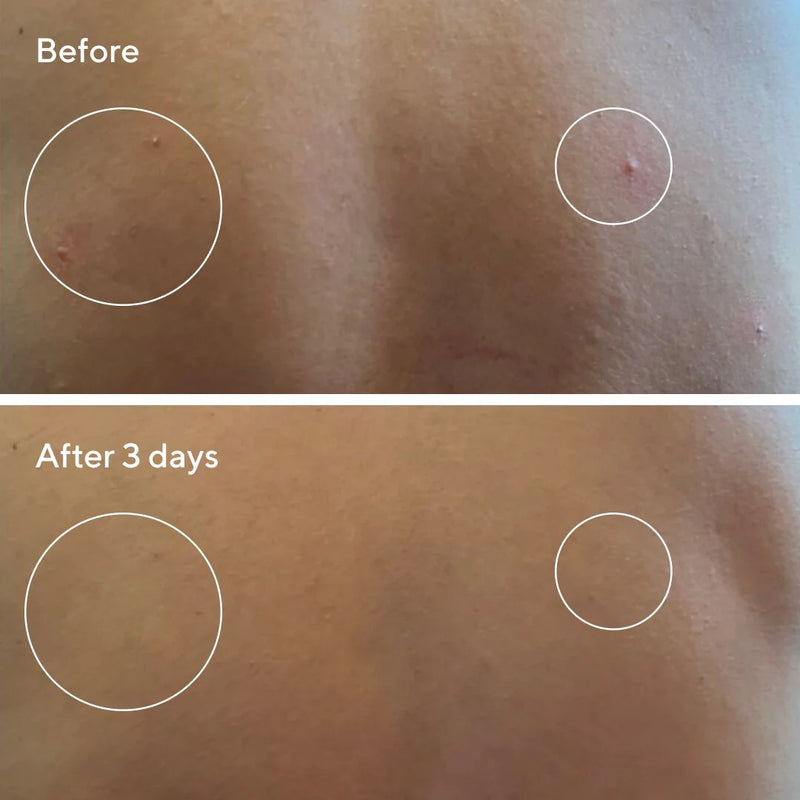 Retexturizing Body Pads