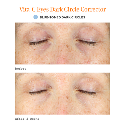 Vita-C Eyes Dark Circle Corrector