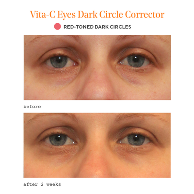 Vita-C Eyes Dark Circle Corrector