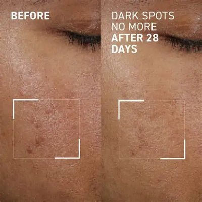 Dr. Brandt Dark Spot No More