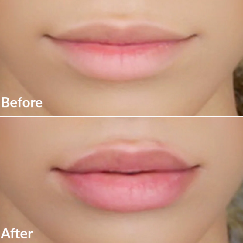 PMD Kiss Lip Plumping System Pink Anti-Aging Lip Enhancing Treatment