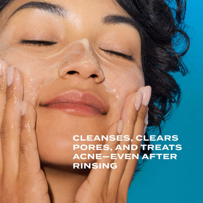 Acne Control Clarifying Cleanser